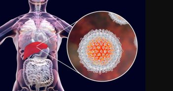 Pro-viraler Faktor GBP1: Neue Einblicke in HCV-Infektionen GBP1 als pro-viraler Faktor: Neue Erkenntnisse bei (Foto: Paul Ehrlich Instritut)
